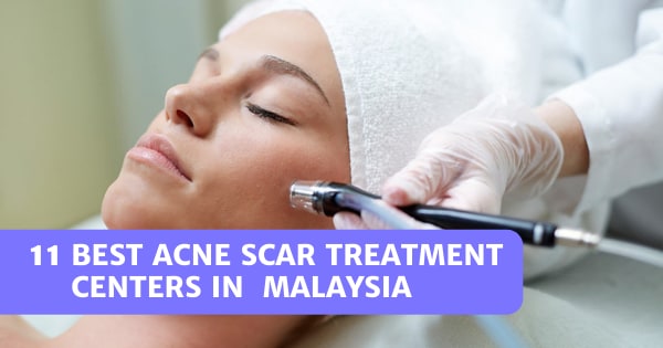 You are currently viewing 11 Best Acne Scar Treatment Centers In Malaysia 2022
