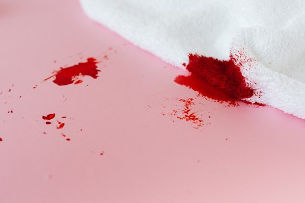 Fresh Blood Stains Are Easier To Remove